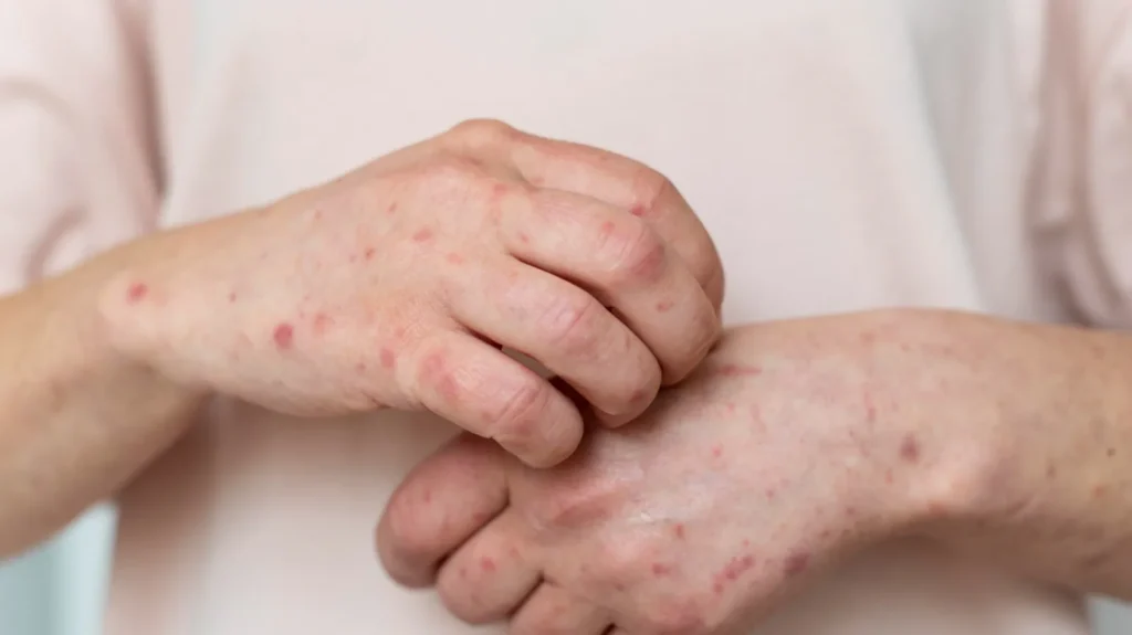 EOUDVMAJBRDBPAEJ6V7DOTKGLQ