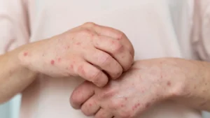 EOUDVMAJBRDBPAEJ6V7DOTKGLQ